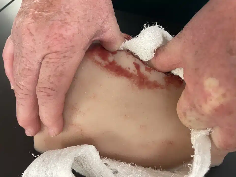 wound-packing